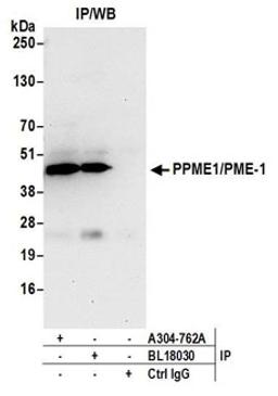 Detection of human PPME1/PME-1 by western blot of immunoprecipitates.