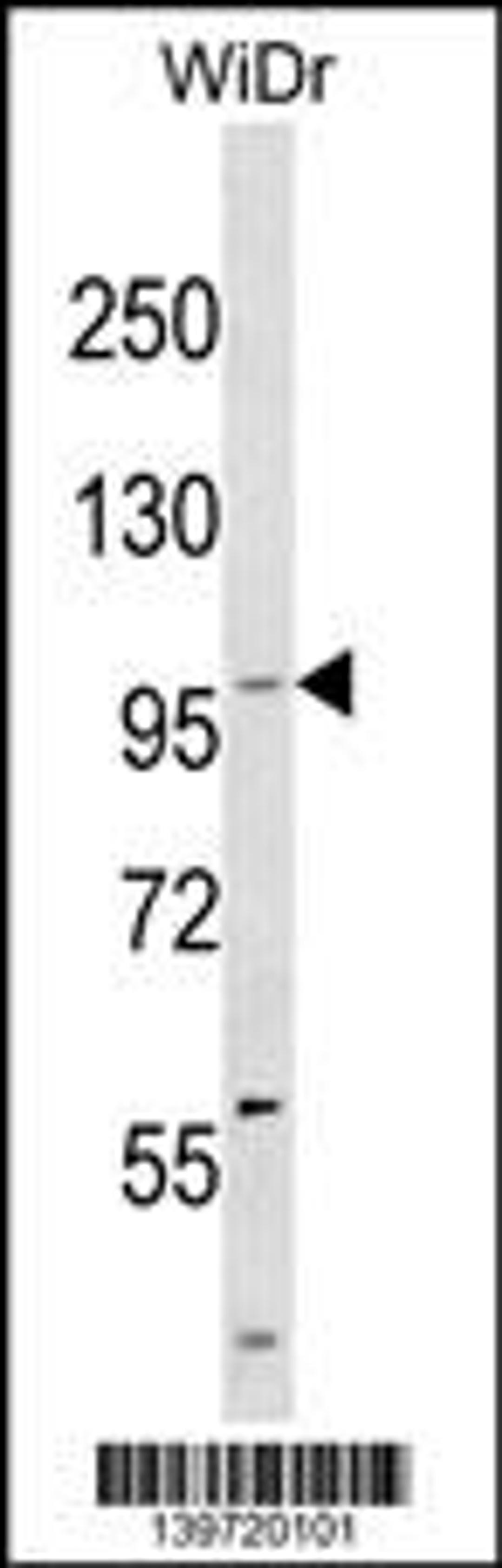 Western blot analysis in WiDr cell line lysates (35ug/lane).This demonstrates the KIT antibody detected the KIT protein (arrow).