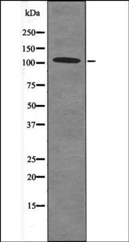 Western blot analysis of HeLa whole cell lysates using Retinoblastoma -Phospho-Thr252- antibody