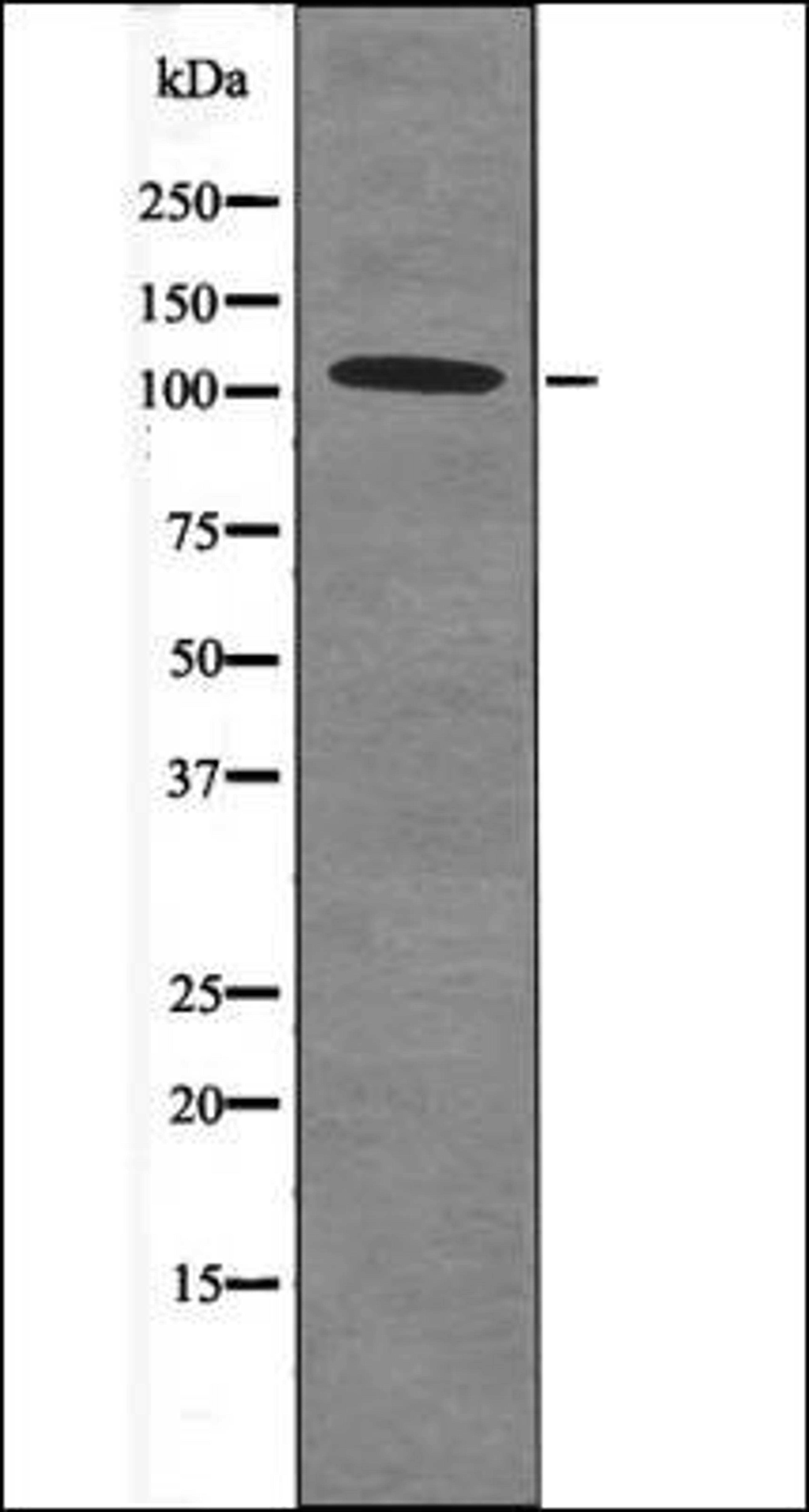 Western blot analysis of HeLa whole cell lysates using Retinoblastoma -Phospho-Thr252- antibody