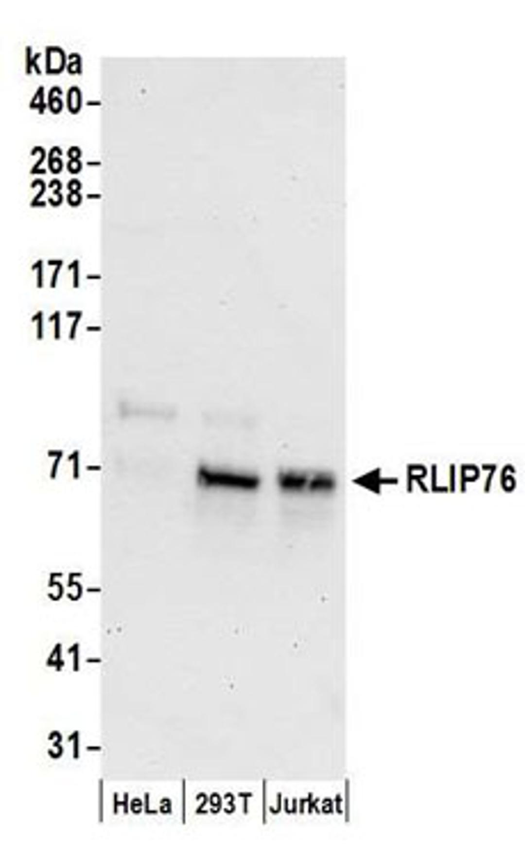 Detection of human RLIP76 by western blot.