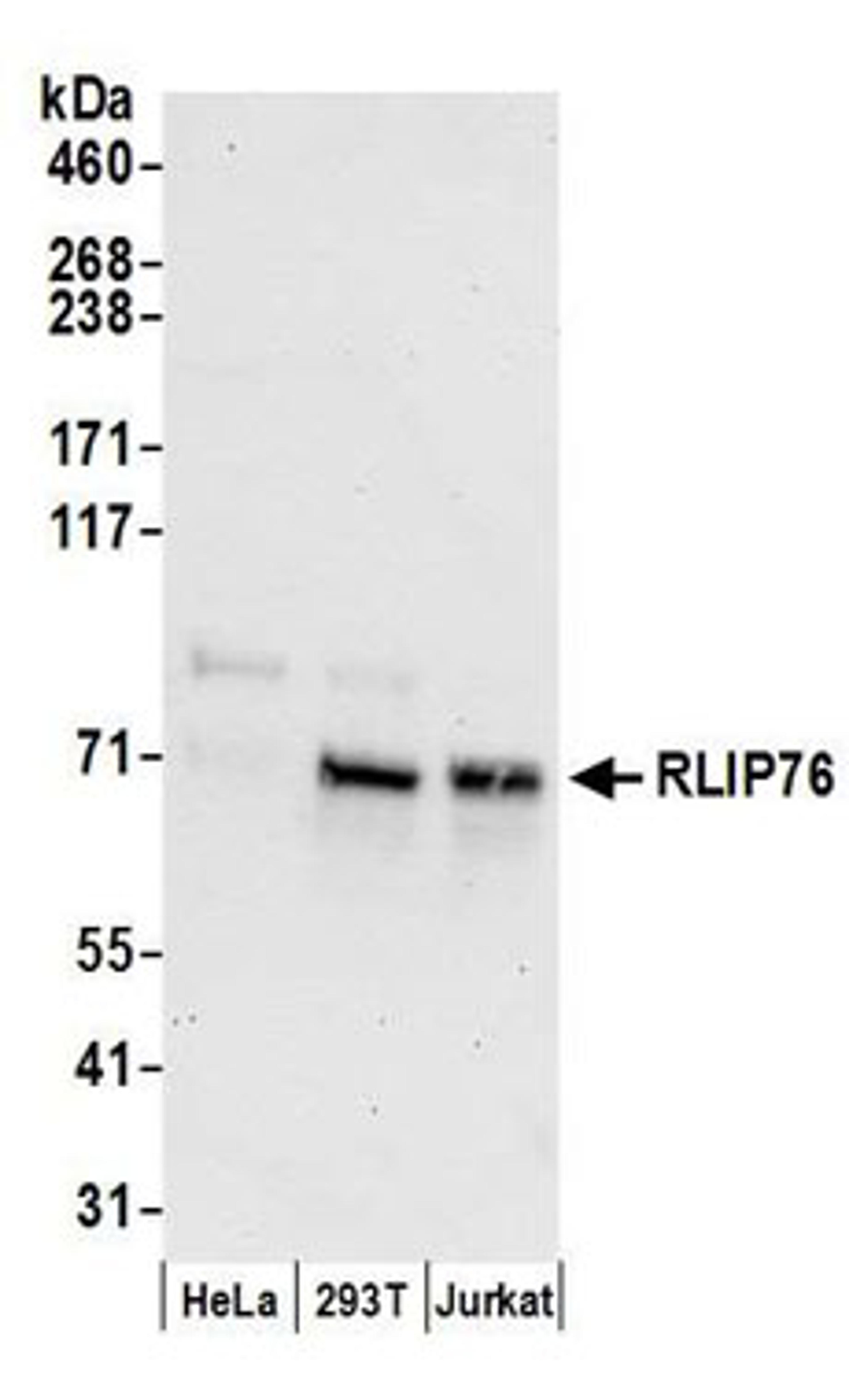 Detection of human RLIP76 by western blot.