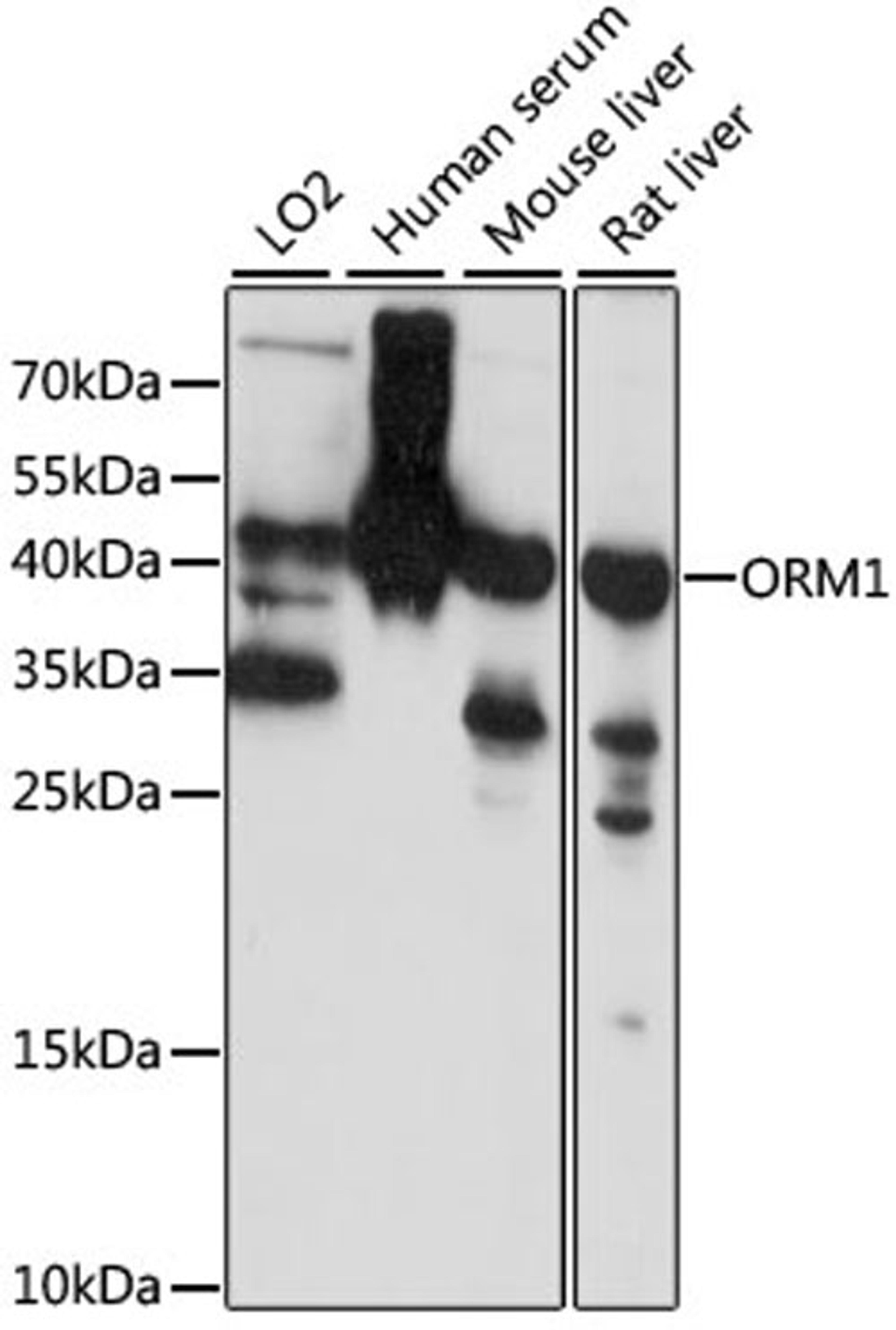 Western blot - ORM1 antibody (A1799)