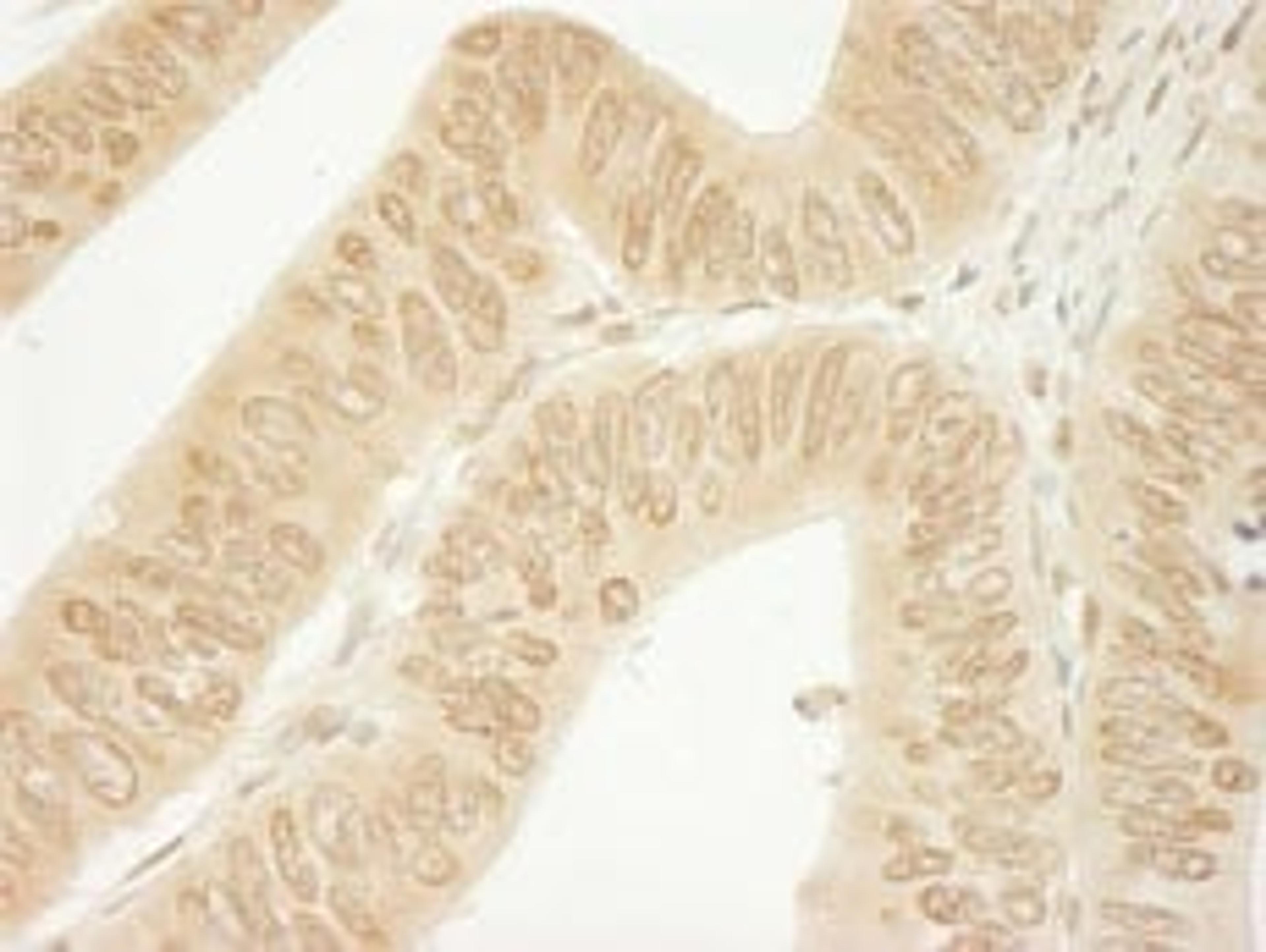 Detection of human CTNND1 by immunohistochemistry.