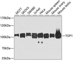 Western blot - TOP1 antibody (A7741)