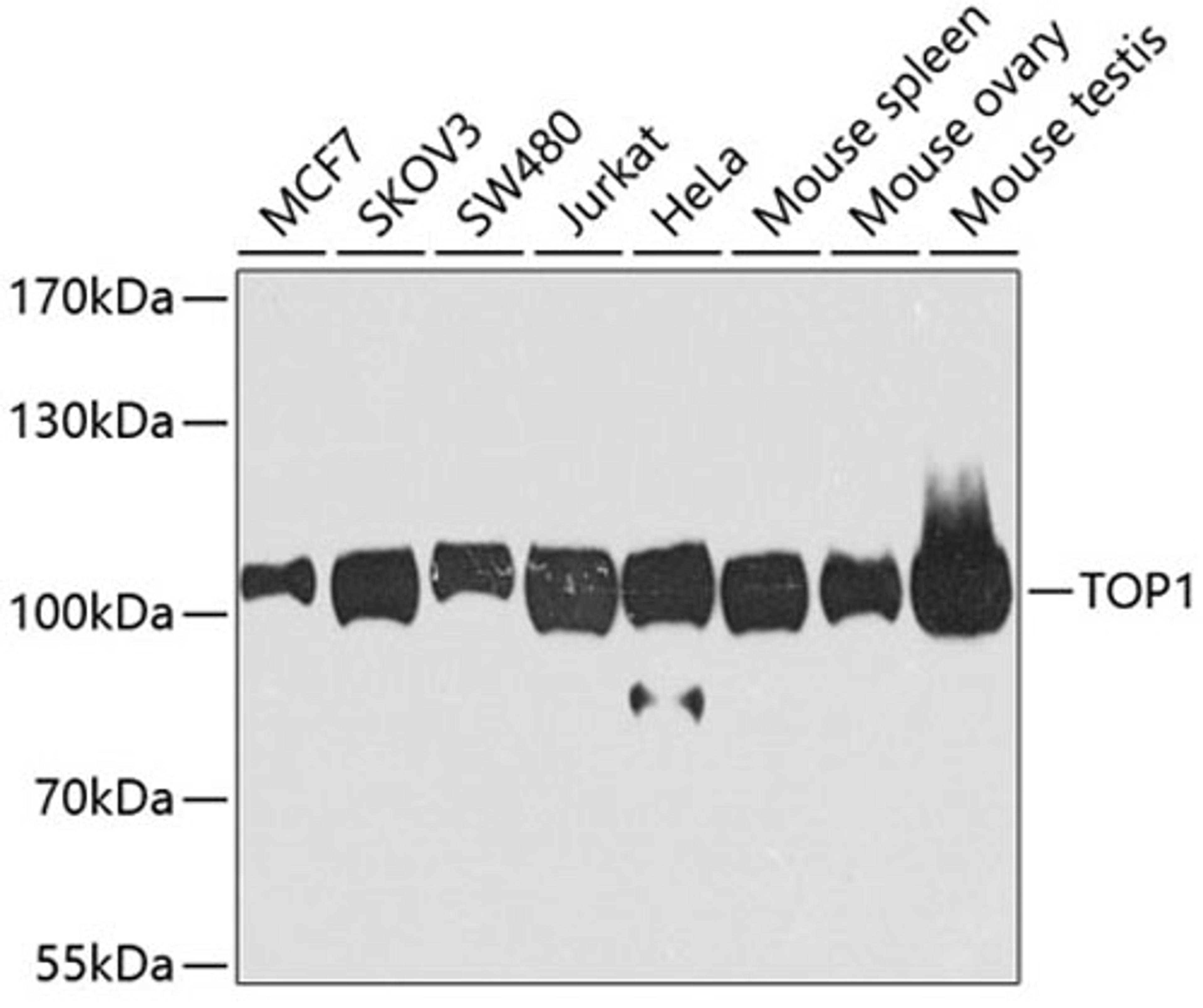 Western blot - TOP1 antibody (A7741)