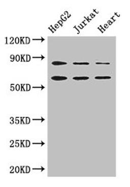 Western Blot. Positive WB detected in: HepG2 whole cell lysate, Jurkat whole cell lysate, Mouse heart tissue. All lanes: STIM2 antibody at 2.8ug/ml. Secondary. Goat polyclonal to rabbit IgG at 1/50000 dilution. Predicted band size: 84, 94, 69 kDa. Observed band size: 84, 69 kDa.