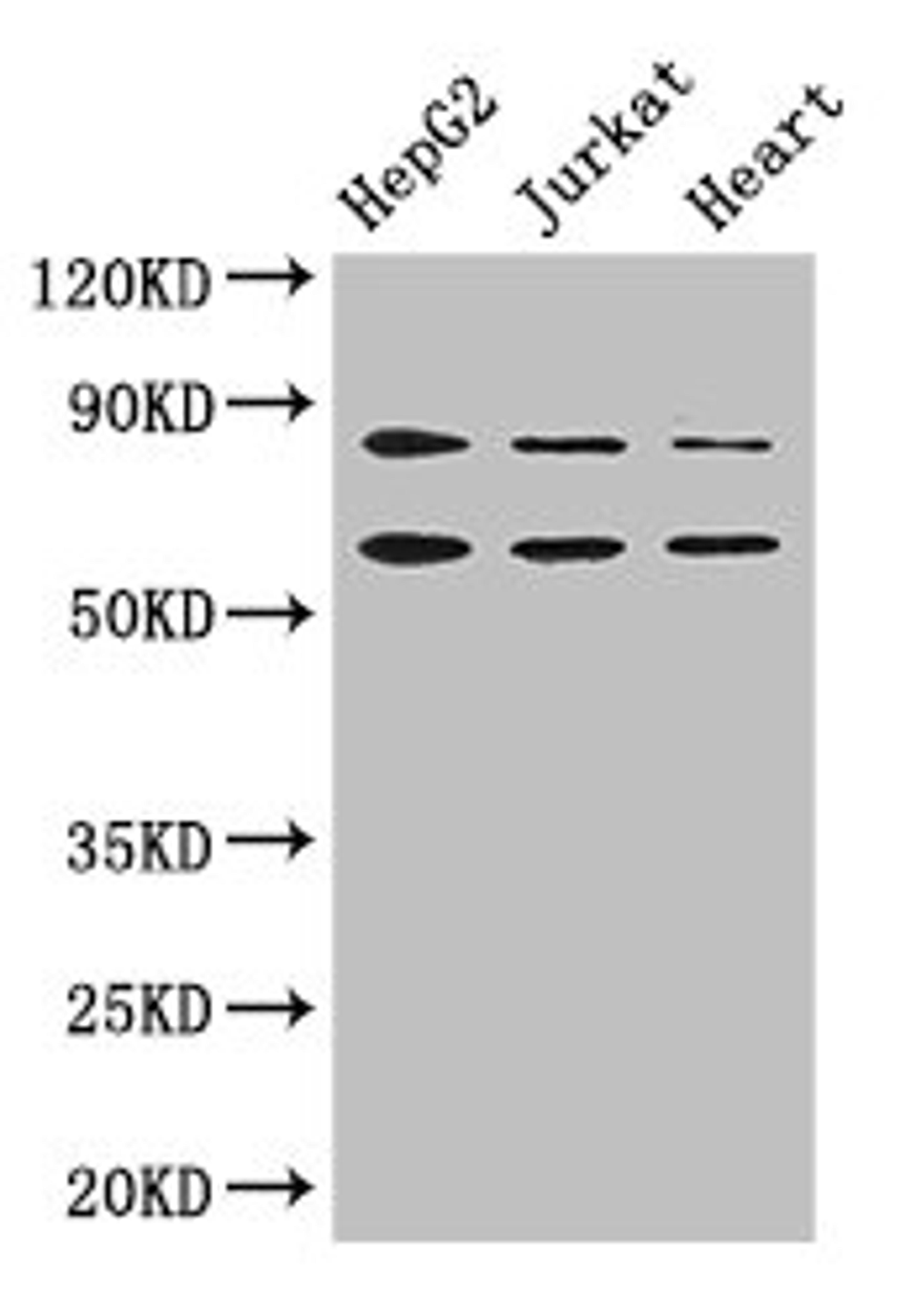 Western Blot. Positive WB detected in: HepG2 whole cell lysate, Jurkat whole cell lysate, Mouse heart tissue. All lanes: STIM2 antibody at 2.8ug/ml. Secondary. Goat polyclonal to rabbit IgG at 1/50000 dilution. Predicted band size: 84, 94, 69 kDa. Observed band size: 84, 69 kDa.
