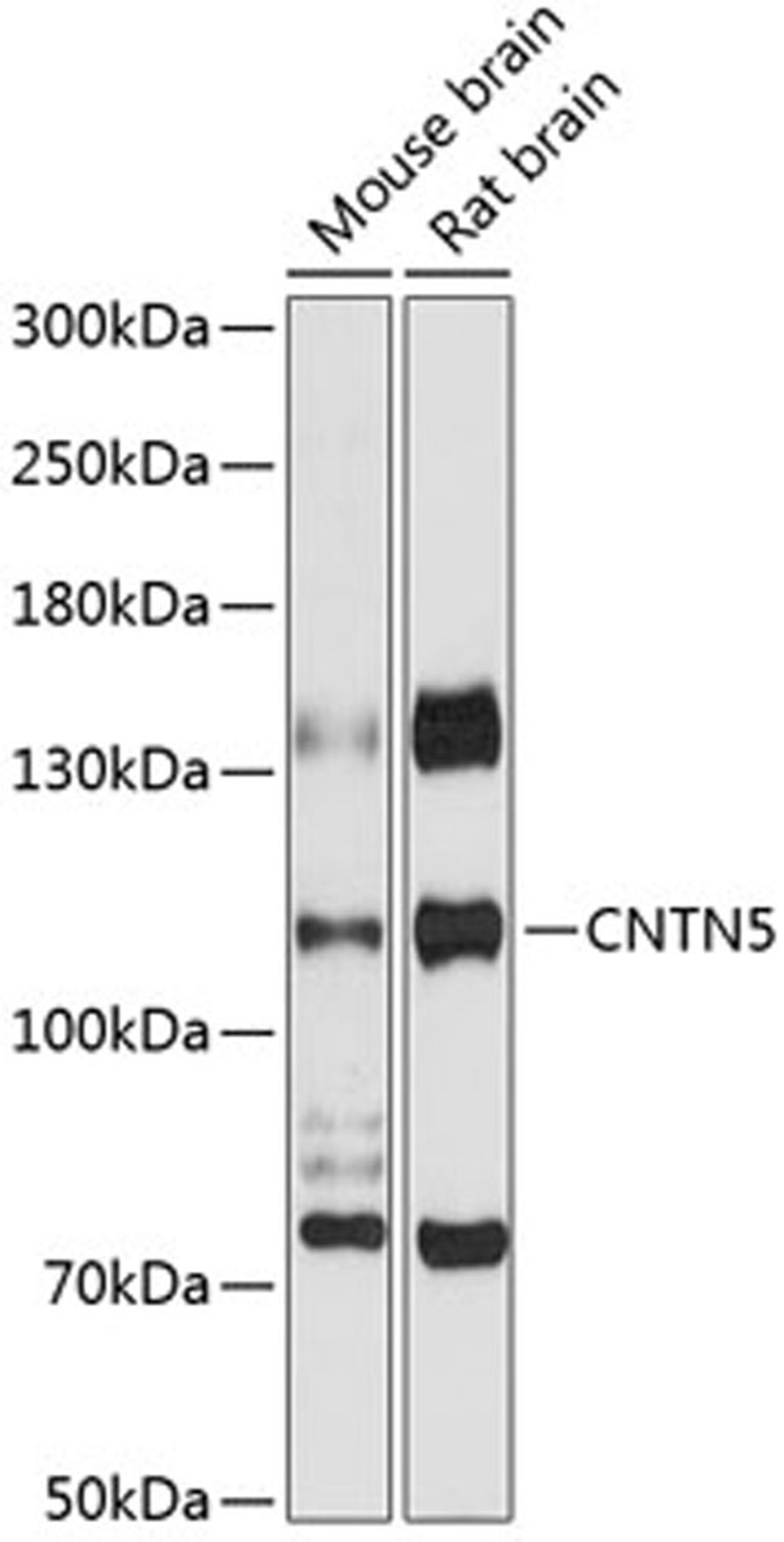 Western blot - CNTN5 antibody (A12655)