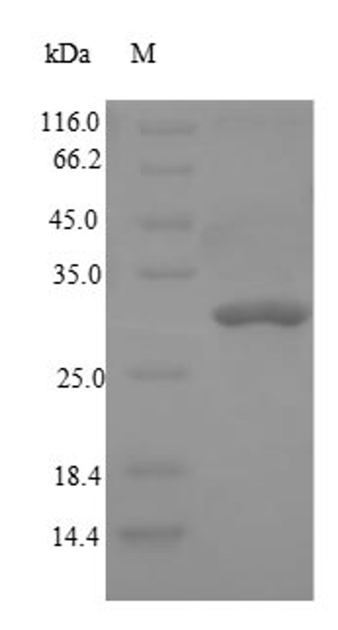(Tris-Glycine gel) Discontinuous SDS-PAGE (reduced) with 5% enrichment gel and 15% separation gel.