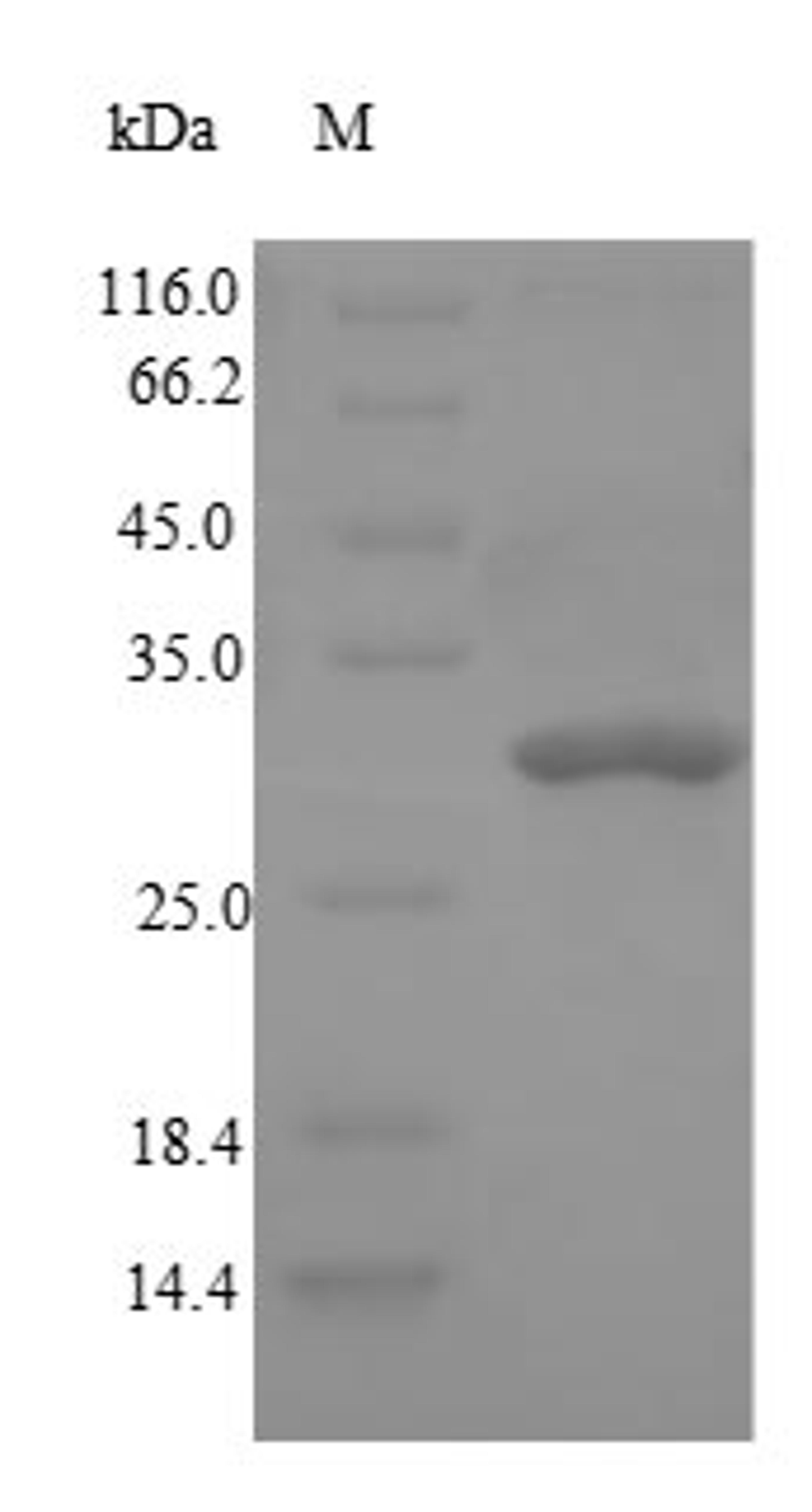 (Tris-Glycine gel) Discontinuous SDS-PAGE (reduced) with 5% enrichment gel and 15% separation gel.