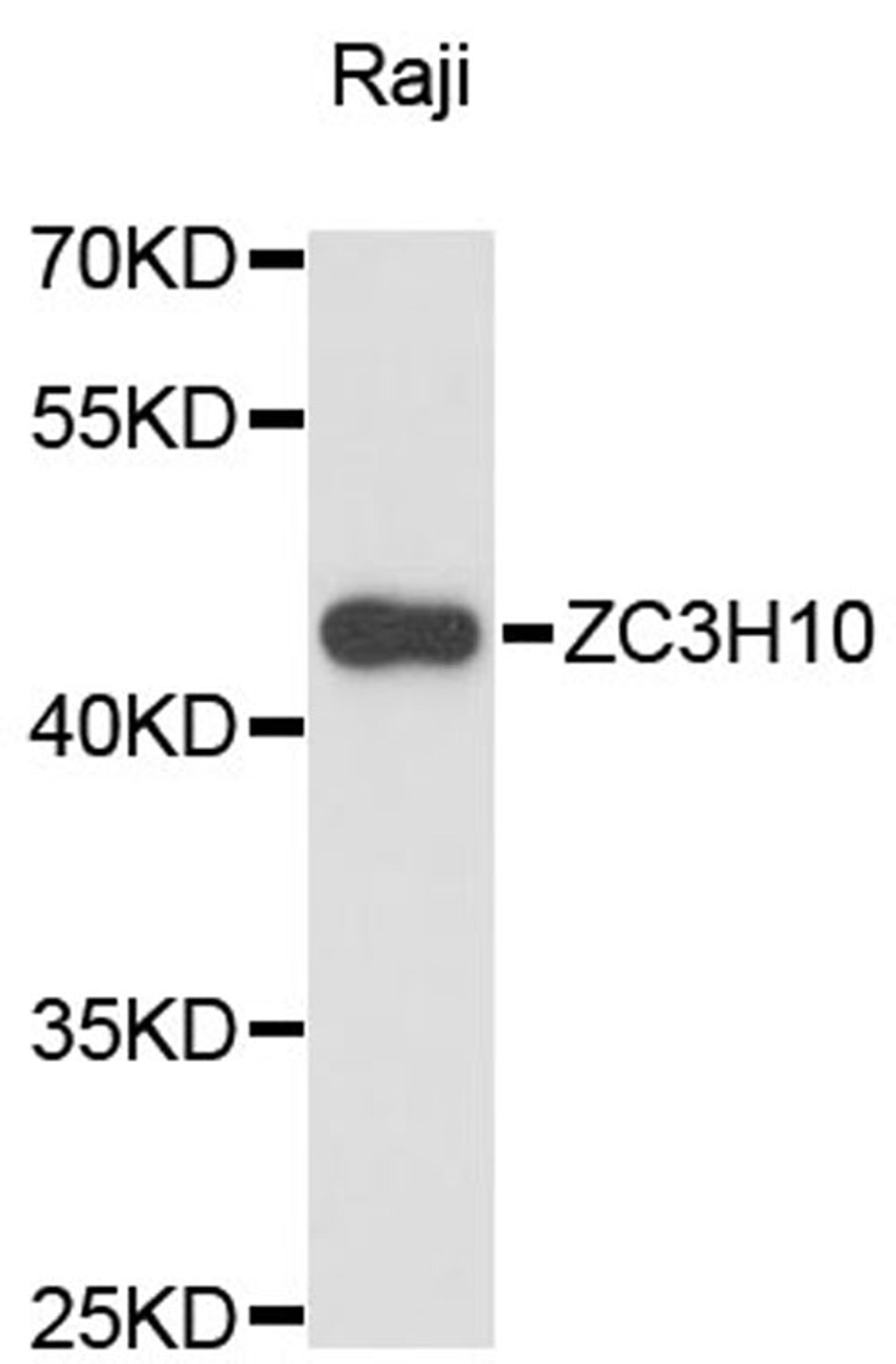 Western blot - ZC3H10 antibody (A13753)