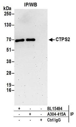 Detection of human CTPS2 by western blot of immunoprecipitates.