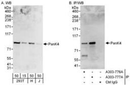 Detection of human PanK4 by western blot and immunoprecipitation.