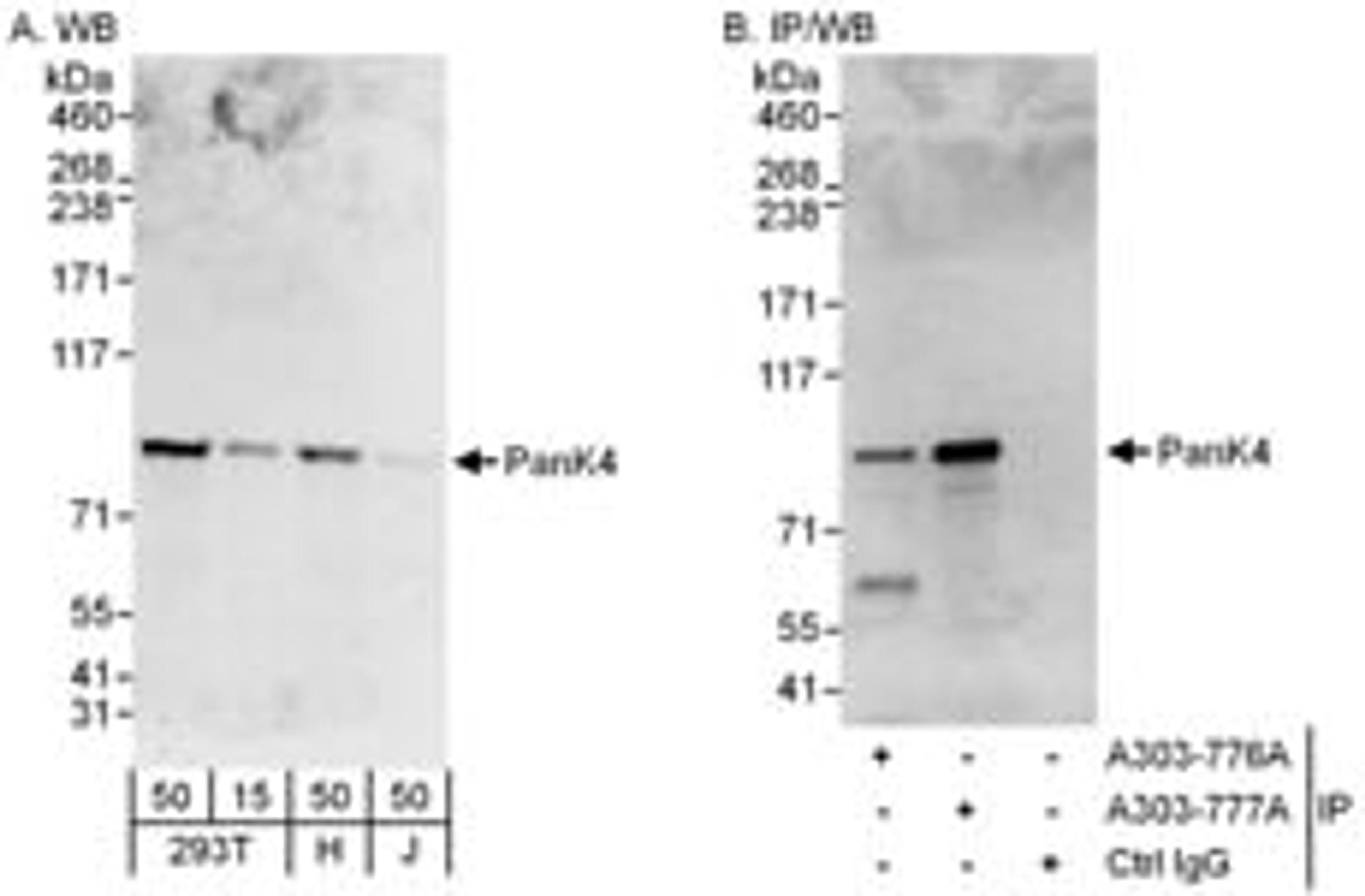 Detection of human PanK4 by western blot and immunoprecipitation.