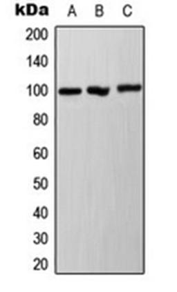 Western blot analysis of A431 (Lane 1), HepG2 (Lane 2), NIH3T3 (Lane 3) whole cell lysates using Ah Receptor (phospho-S36) antibody