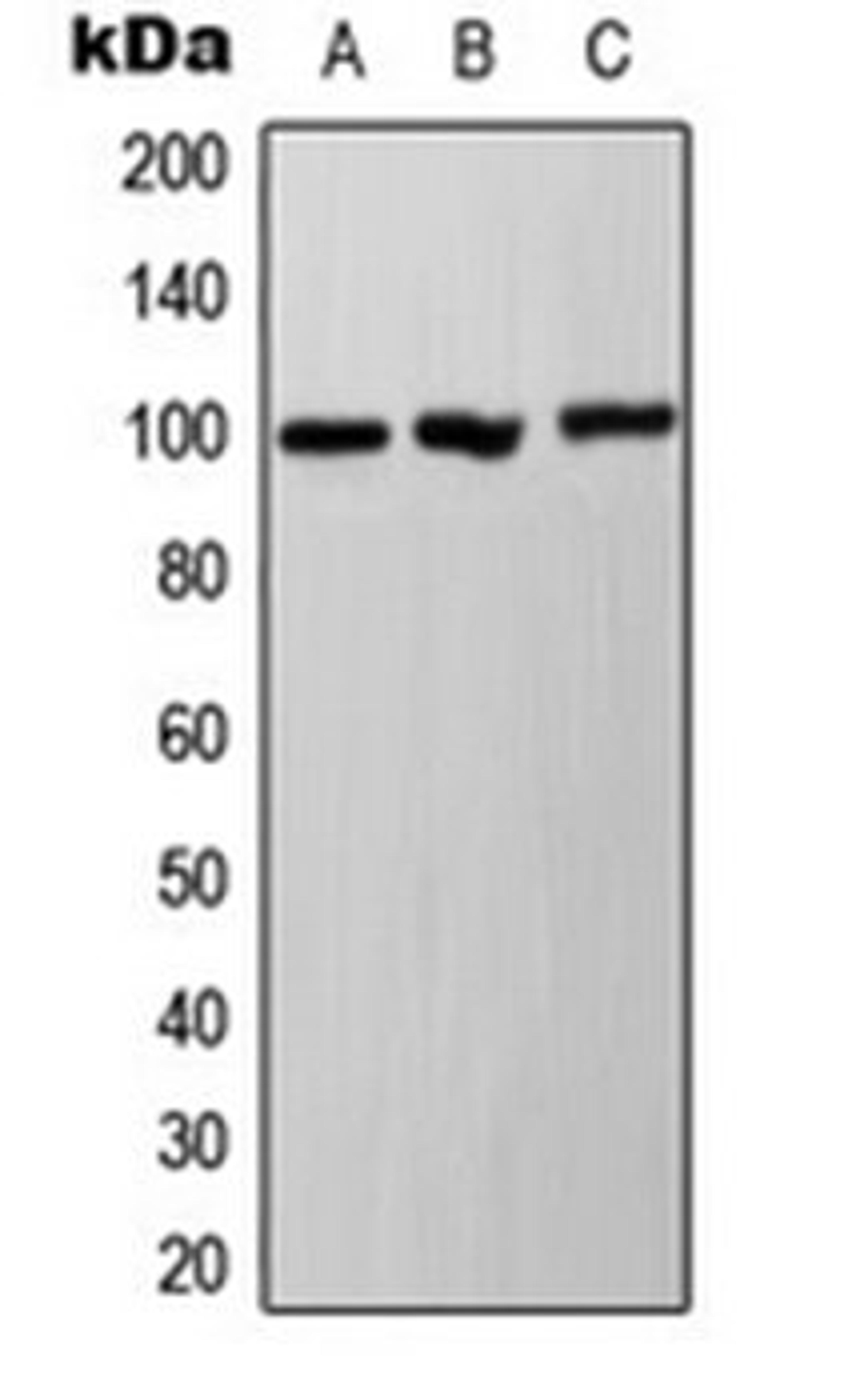 Western blot analysis of A431 (Lane 1), HepG2 (Lane 2), NIH3T3 (Lane 3) whole cell lysates using Ah Receptor (phospho-S36) antibody