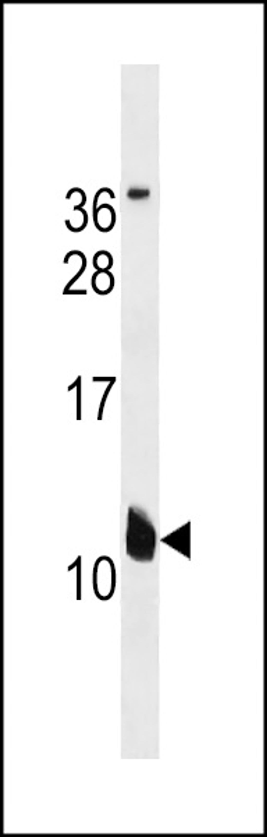 Western blot analysis in A549 cell line lysates (35ug/lane).