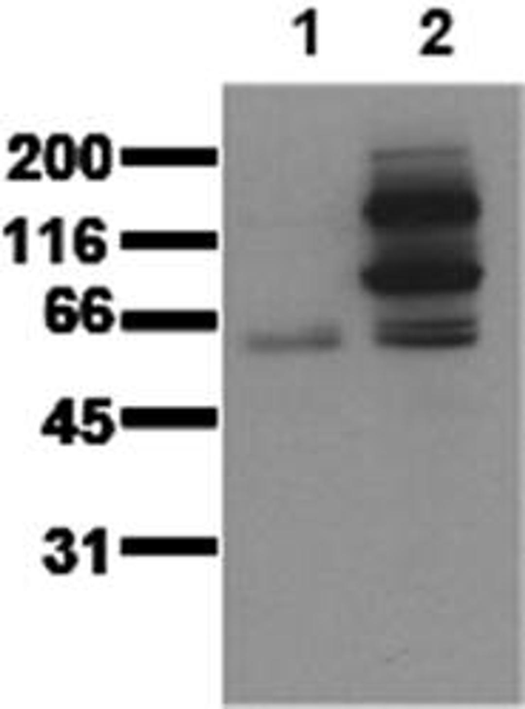 Western blot analysis of Catenin beta, pTyr 654 antibody in whole cell lysates