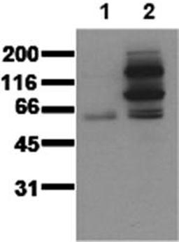 Western blot analysis of Catenin beta, pTyr 654 antibody in whole cell lysates