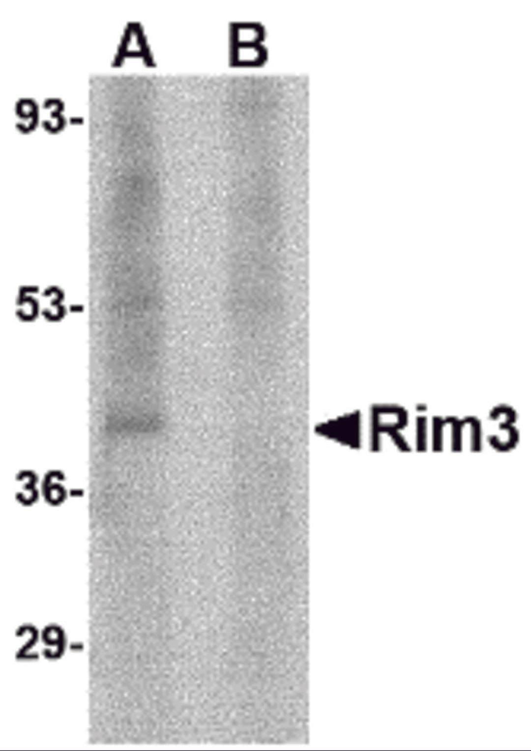 Western blot analysis of Rim3 in human brain tissue lysate with Rim3 antibody at 1 &#956;g/mL in the (A) absence and (B) presence of blocking peptide.