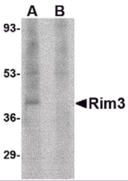 Western blot analysis of Rim3 in human brain tissue lysate with Rim3 antibody at 1 &#956;g/mL in the (A) absence and (B) presence of blocking peptide.