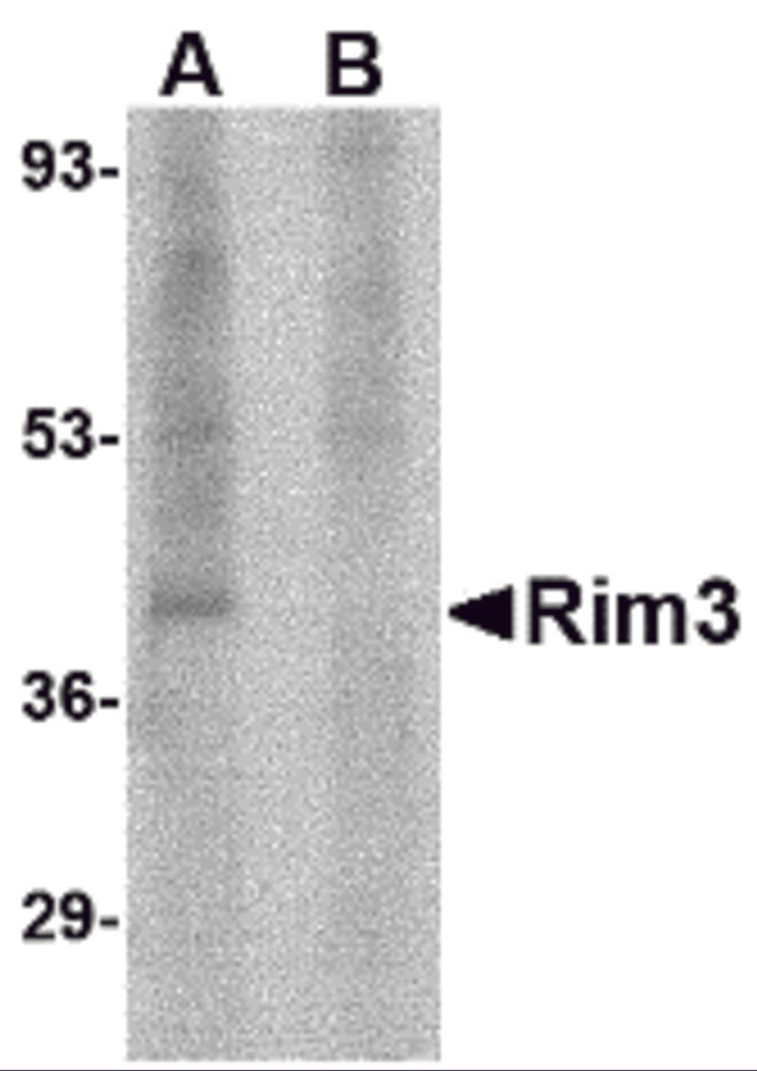 Western blot analysis of Rim3 in human brain tissue lysate with Rim3 antibody at 1 μg/mL in the (A) absence and (B) presence of blocking peptide.