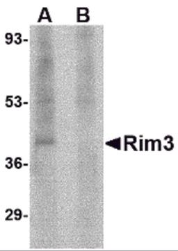 Western blot analysis of Rim3 in human brain tissue lysate with Rim3 antibody at 1 μg/mL in the (A) absence and (B) presence of blocking peptide.
