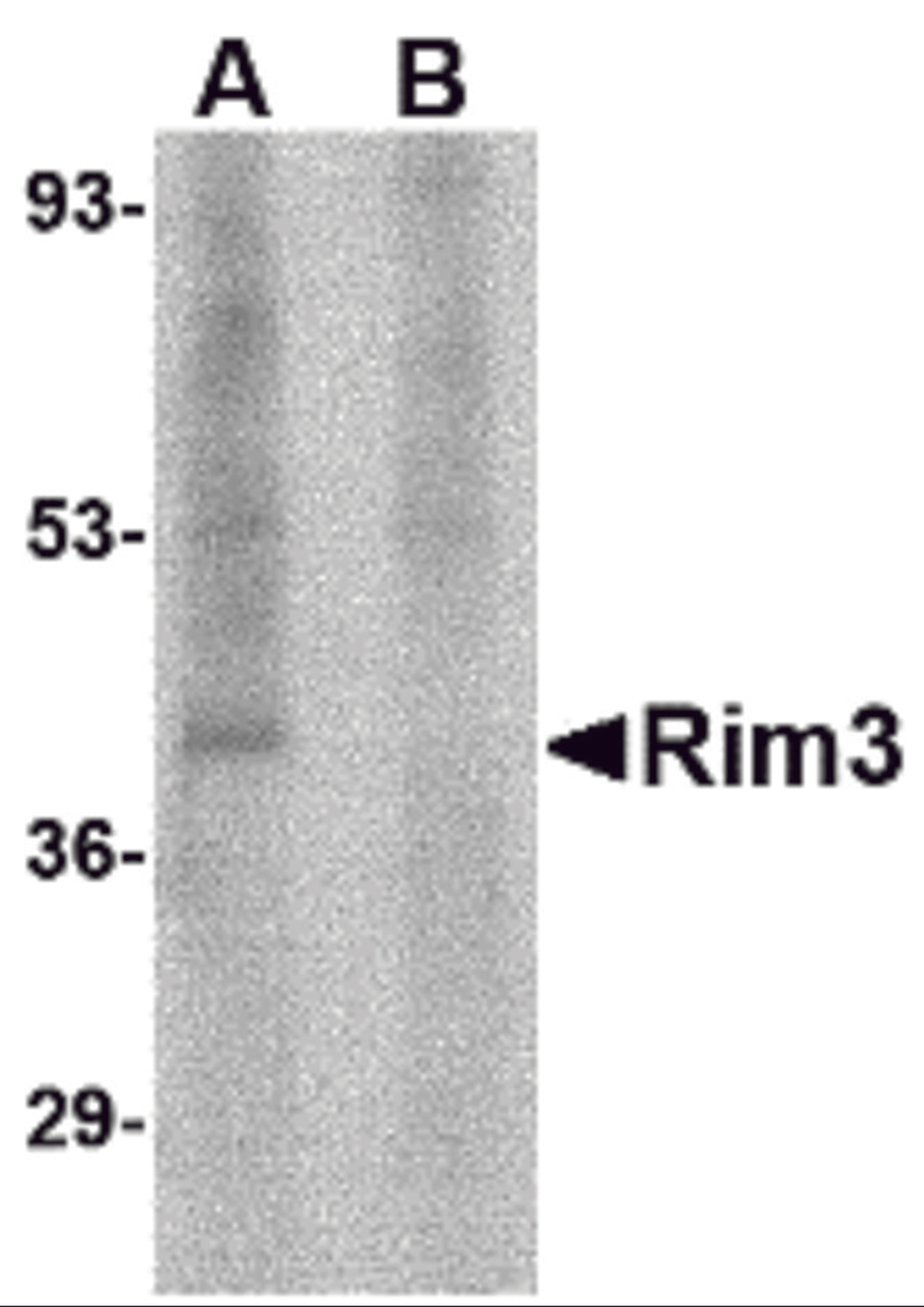 Western blot analysis of Rim3 in human brain tissue lysate with Rim3 antibody at 1 μg/mL in the (A) absence and (B) presence of blocking peptide.