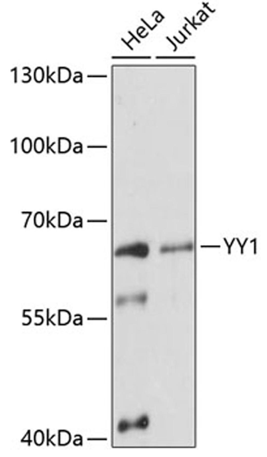 Western blot - YY1 Antibody (A12928)