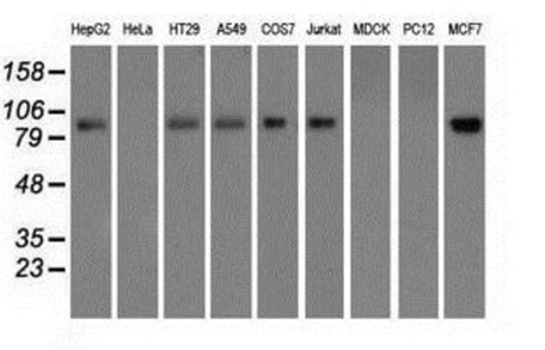 Western Blot: Glucose 1-dehydrogenase Antibody (2A7) [NBP2-02615] Analysis of extracts (35ug) from 9 different cell lines by using anti-Glucose 1-dehydrogenase monoclonal antibody.