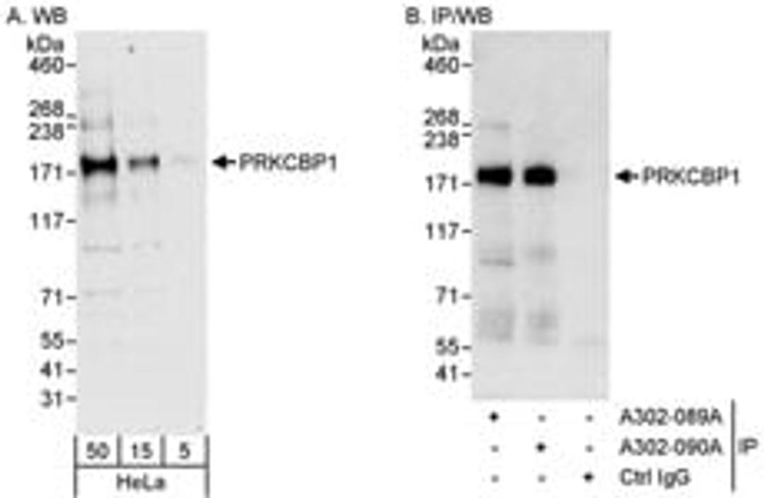 Detection of human PRKCBP1 by western blot and immunoprecipitation.