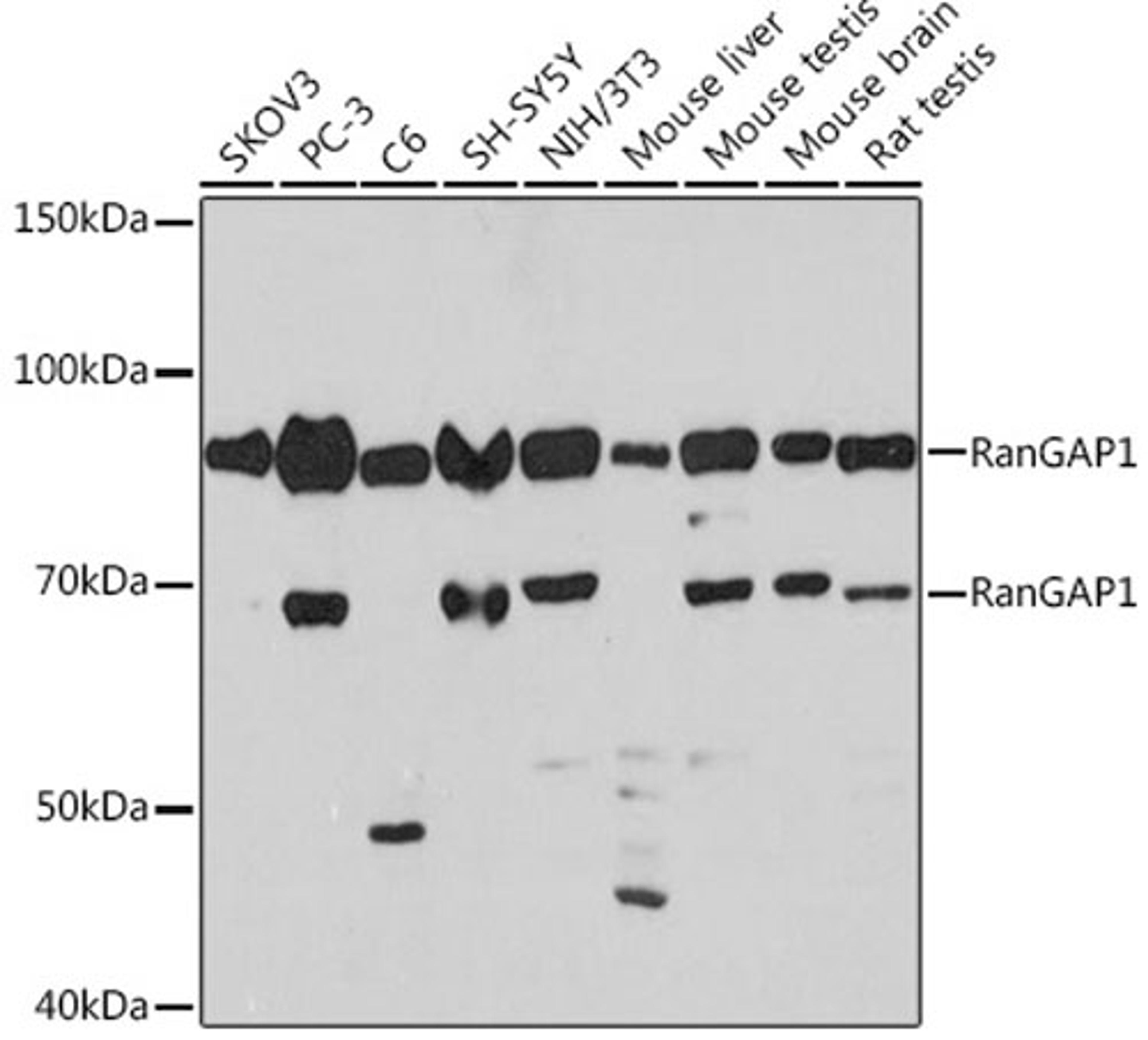 Western blot - RanGAP1 Rabbit mAb (A8758)