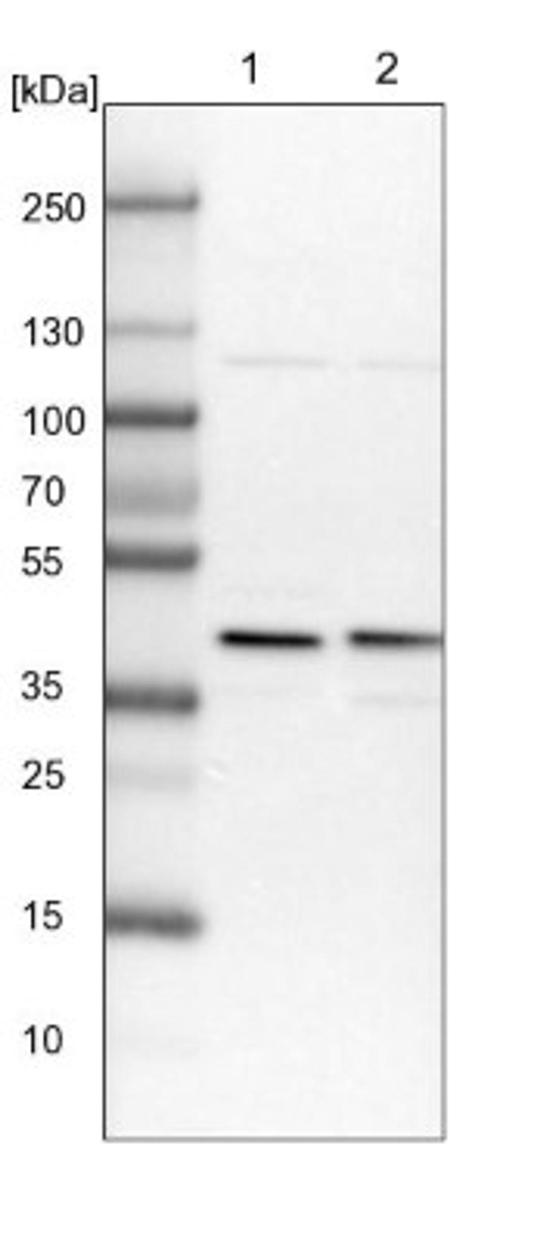 Western Blot: BRIX Antibody [NBP1-91708] - Lane 1: NIH-3T3 cell lysate (Mouse embryonic fibroblast cells)<br/>Lane 2: NBT-II cell lysate (Rat Wistar bladder tumour cells)