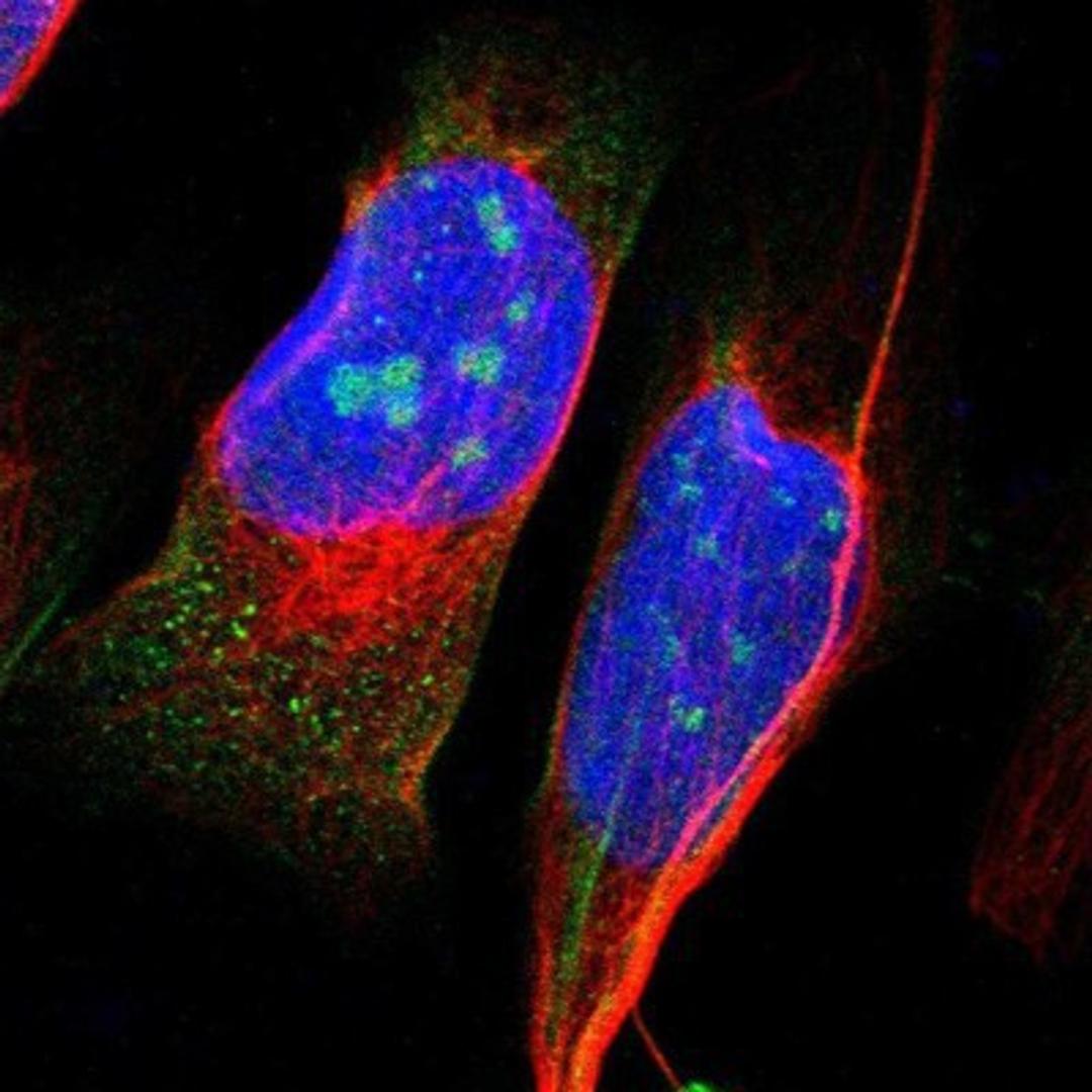 Immunocytochemistry/Immunofluorescence: ZEB2 Antibody [NBP1-82991] Staining of human cell line U-2 OS shows positivity in nucleoli & cytoplasm.