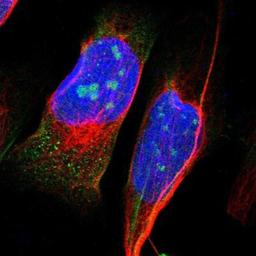 Immunocytochemistry/Immunofluorescence: ZEB2 Antibody [NBP1-82991] Staining of human cell line U-2 OS shows positivity in nucleoli & cytoplasm.