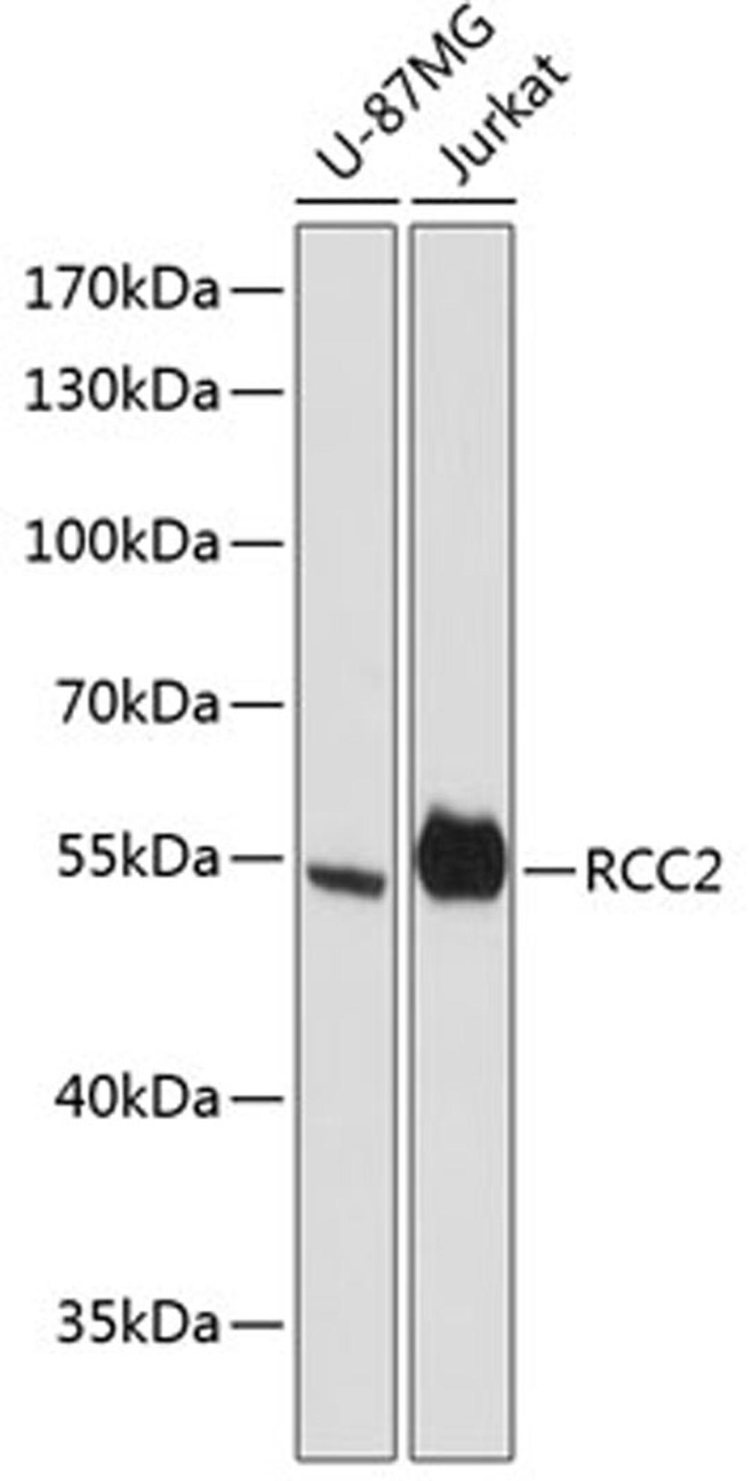 Western blot - RCC2 antibody (A13105)