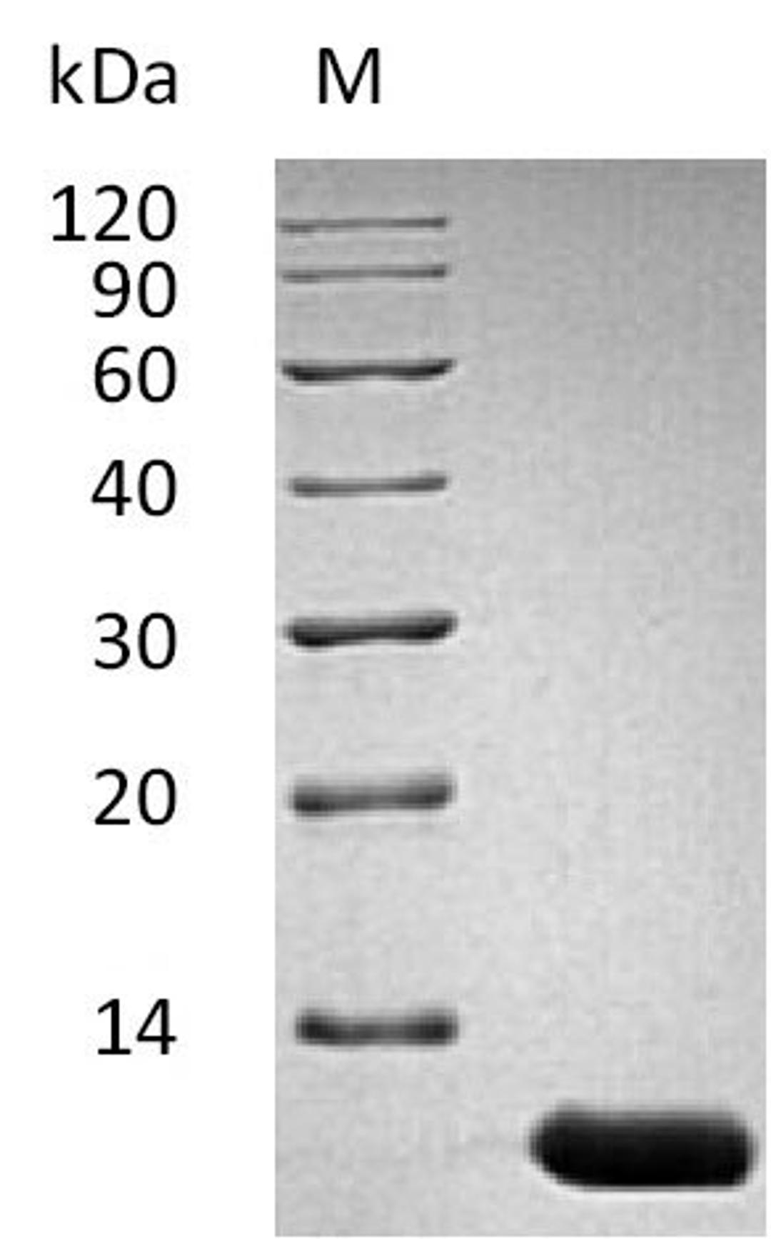 (Tris-Glycine gel) Discontinuous SDS-PAGE (reduced) with 5% enrichment gel and 15% separation gel.