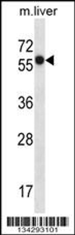 Western blot analysis in mouse liver tissue lysates (35ug/lane).