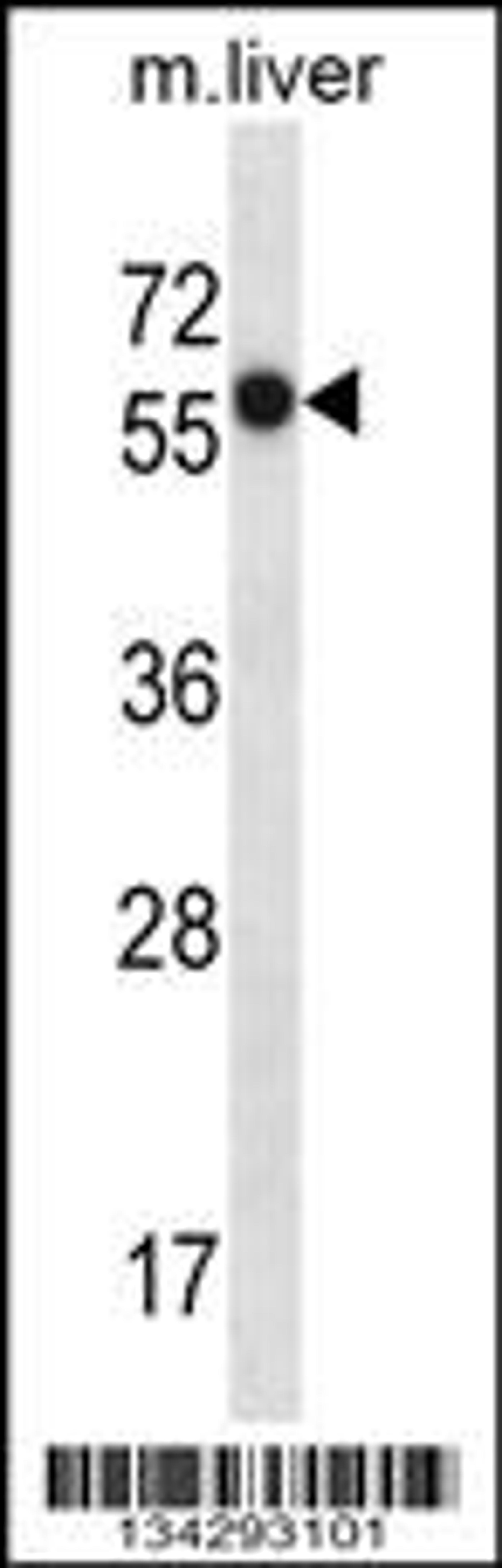 Western blot analysis in mouse liver tissue lysates (35ug/lane).