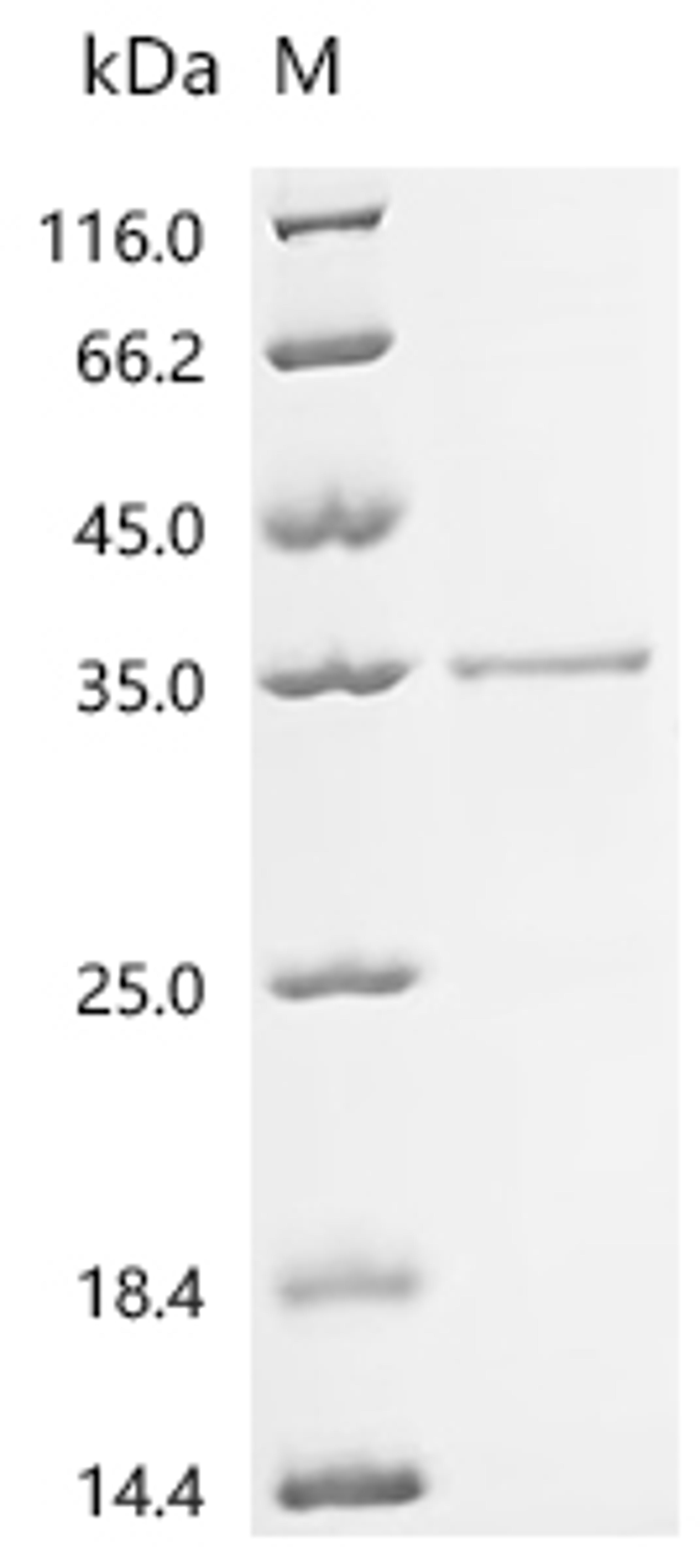 (Tris-Glycine gel) Discontinuous SDS-PAGE (reduced) with 5% enrichment gel and 15% separation gel.