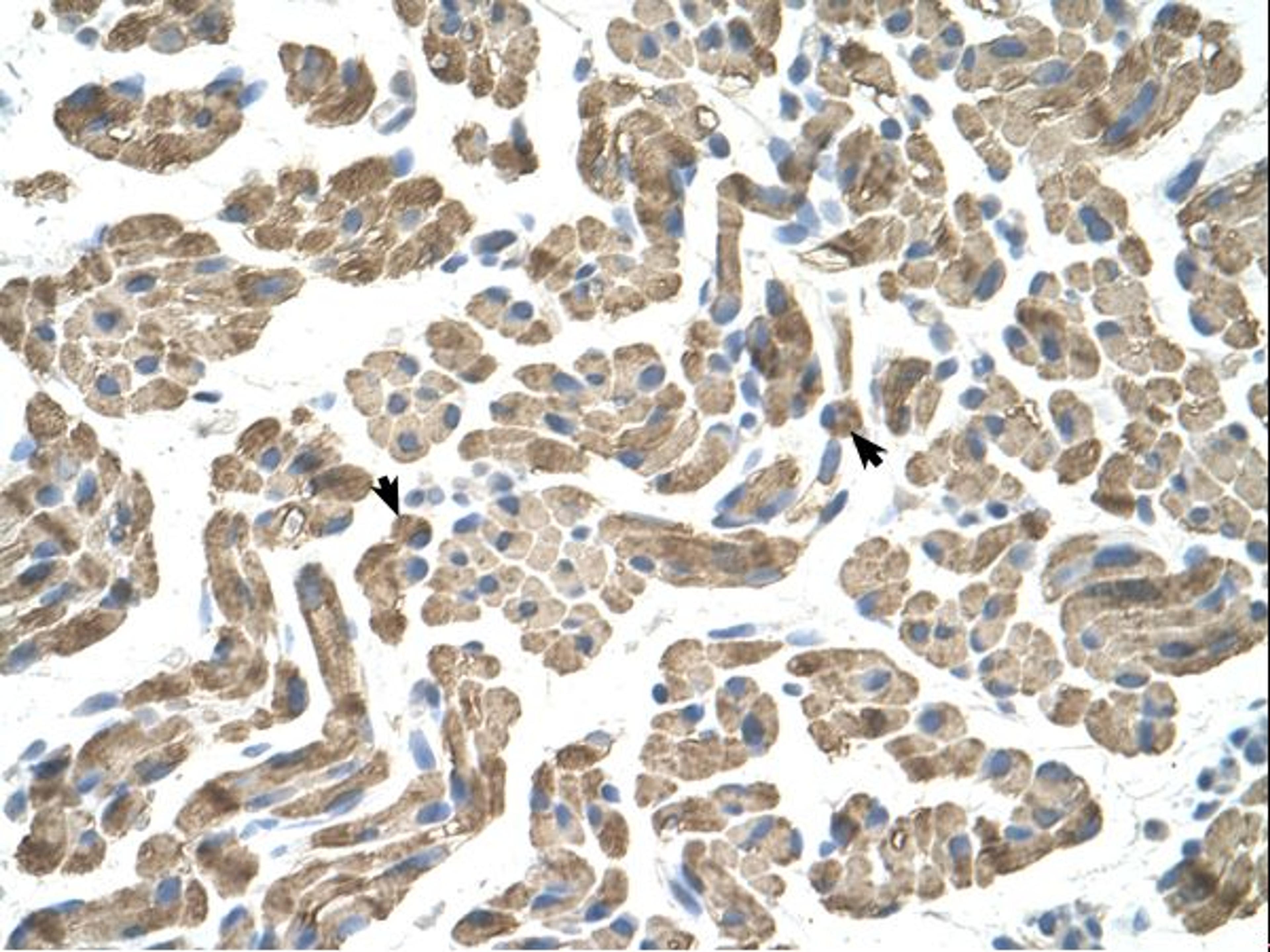 Antibody used in IHC on Human Muscle.