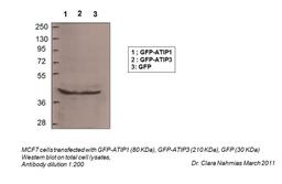 Antibody used in WB on Total.