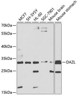 Western blot - DAZL antibody (A1114)