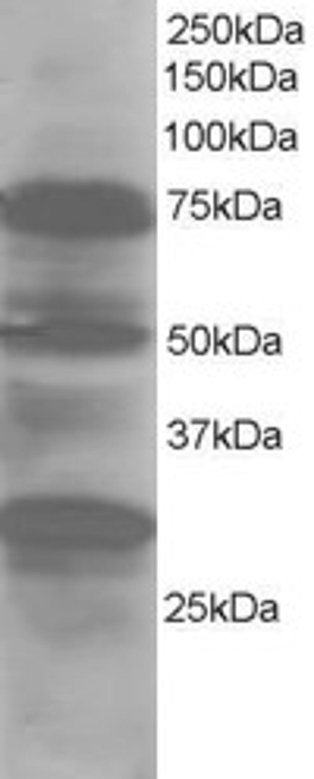 45-843 staining (1ug/ml) of Human Lung lysate (RIPA buffer, 30ug total protein per lane). Primary incubated for 1 hour. Detected by western blot using chemiluminescence.