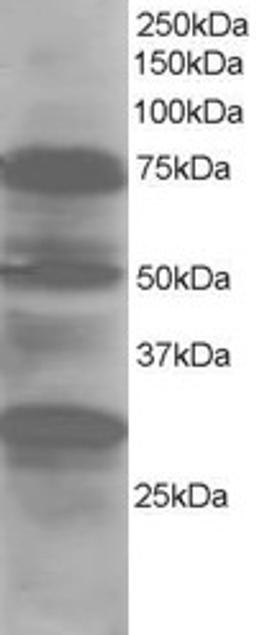 45-843 staining (1ug/ml) of Human Lung lysate (RIPA buffer, 30ug total protein per lane). Primary incubated for 1 hour. Detected by western blot using chemiluminescence.