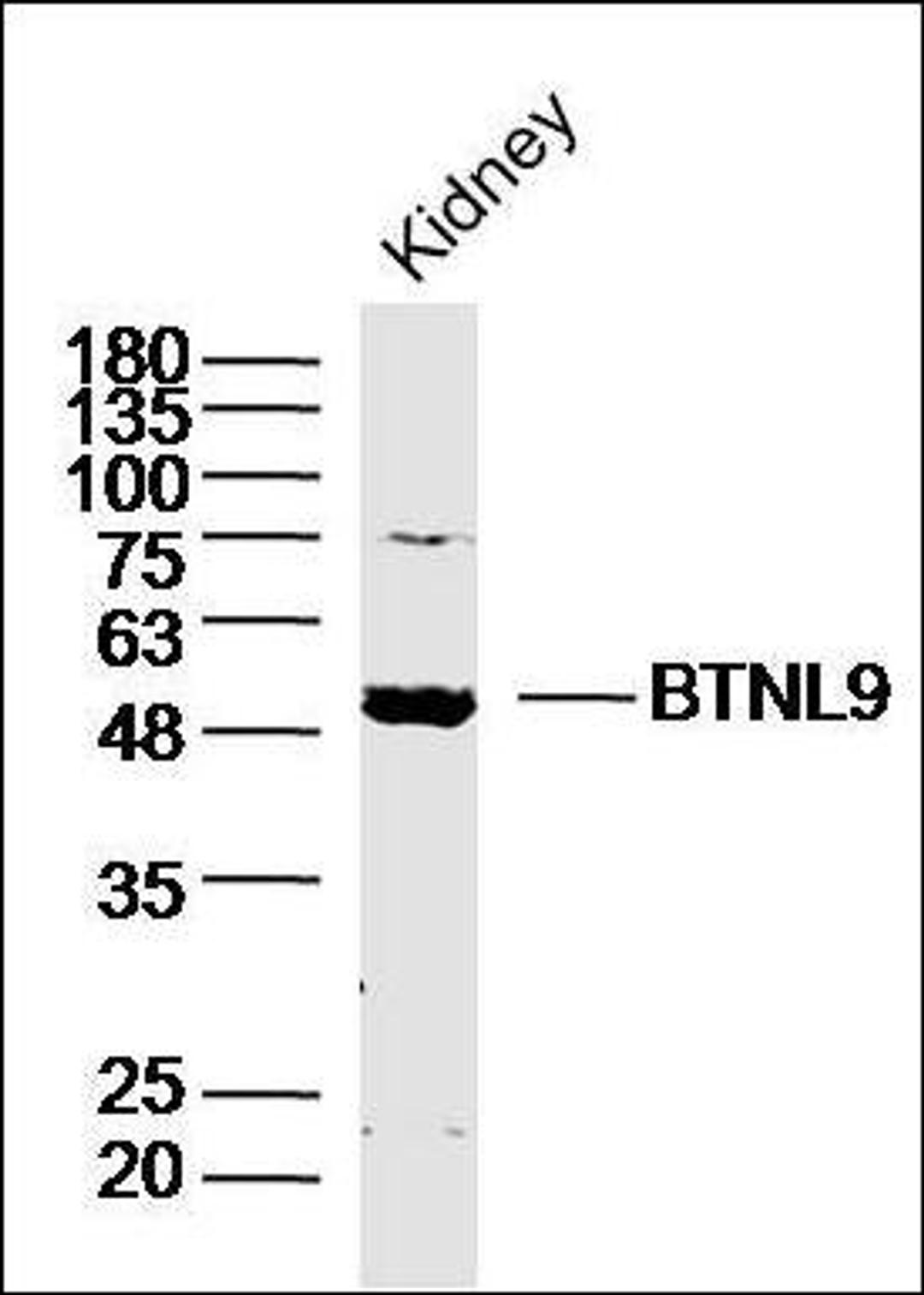 Western blot analysis of Mose Kidney Lysate using BTNL9 antibody.