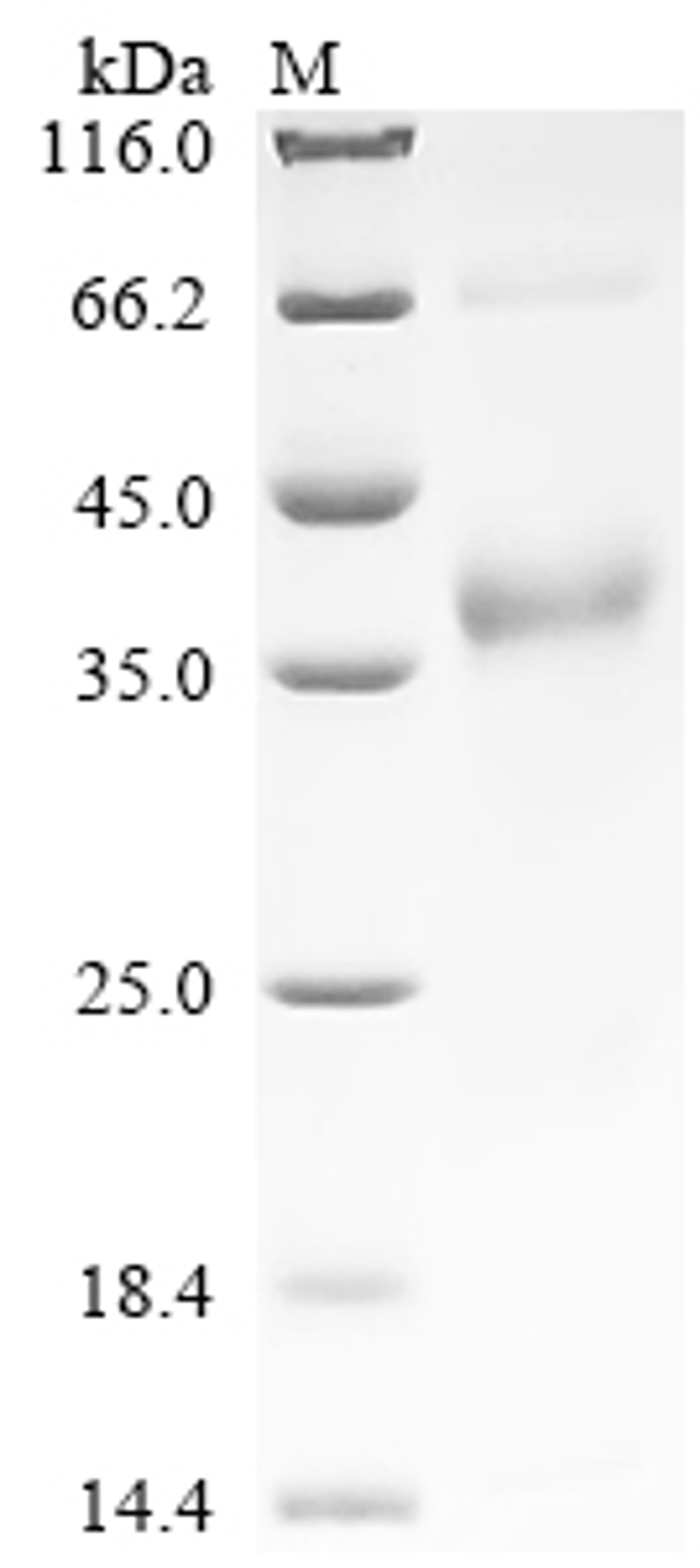 (Tris-Glycine gel) Discontinuous SDS-PAGE (reduced) with 5% enrichment gel and 15% separation gel.