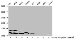 Western Blot. Detected samples: 293 whole cell lysate, A549 whole cell lysate, K562 whole cell lysate, Jurkat whole cell lysate; Untreated (-) or treated (+) with 30mM sodium butyrate for 4h. All lanes: HIST1H4A antibody at 1:100. Secondary. Goat polyclonal to rabbit IgG at 1/50000 dilution. Predicted band size: 12 kDa. Observed band size: 12 kDa
