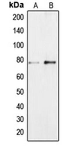 Western blot analysis of Jurkat (Lane 1), NIH3T3 (Lane 2) whole cell lysates using BRF1 antibody